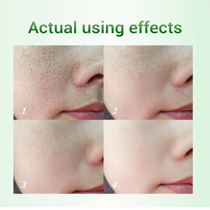 Salicylic Acid Pore Refinement Cream Lotion Skin